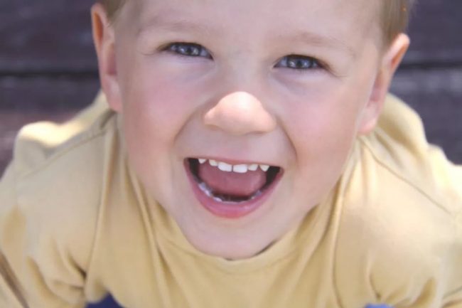 deglucion atipica en Valencia - niño con problema