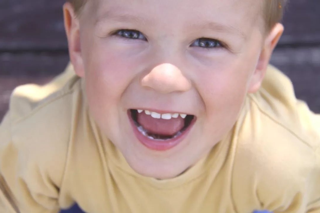 deglucion atipica en Valencia – niño con problema deglucion atipica en Valencia - niño con problema